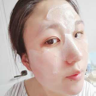 메디타임 멜라반 더마 토닝 씬젤 — 4점을 준 리뷰어가 2019년 6월 올린 사용 사진