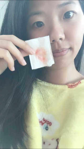 미팩토리 립앤아이 리무버 — 5점을 준 리뷰어가 2018년 2월 올린 사용 사진