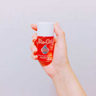 Bio-oil(바이오오일) 바이오오일 — 5점을 준 리뷰어가 2016년 10월 올린 사용 사진