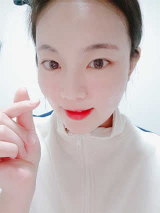 메디타임 멜라반 더마 토닝 씬젤 — 5점을 준 리뷰어가 2019년 4월 올린 사용 사진