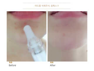 04mini04님이 올린 리뷰 사진 2