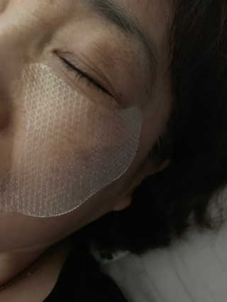 메디타임 멜라반 더마 토닝 씬젤 — 4점을 준 리뷰어가 2019년 4월 올린 사용 사진