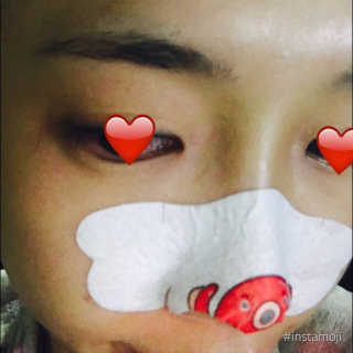 나이팅게일 TAKO PACK NOSE [문어코팩] — 2.5점을 준 리뷰어가 2017년 4월 올린 사용 사진