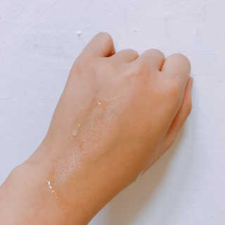 아이소이 아크니 닥터 1st 컨트롤 토닉 — 5점을 준 리뷰어가 2018년 6월 올린 사용 사진