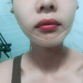 아이디플라코스메틱 아이디 페이스핏 마이너스 밴드 — 4점을 준 리뷰어가 2019년 10월 올린 사용 사진