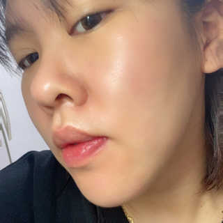 입큰뉴욕 비얼라우 제주 곰솔잎 밝은 앰플 — 5점을 준 리뷰어가 2020년 2월 올린 사용 사진
