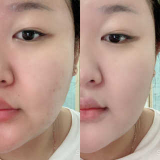 [라보드더마펌] 듀얼 콜라제닉 쿠션 — 5점을 준 리뷰어가 2019년 9월 올린 사용 사진