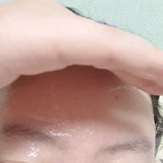 메디타임 멜라반 더마 토닝 씬젤 — 5점을 준 리뷰어가 2019년 5월 올린 사용 사진
