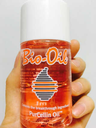 Bio-oil(바이오오일) 바이오오일(Bio-oil) — 5점을 준 리뷰어가 2016년 12월 올린 사용 사진