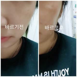 루이스 비드마 레메덤 페이스 크림 50ml — 5점을 준 리뷰어가 2018년 11월 올린 사용 사진
