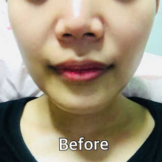 sylvia0307님이 올린 리뷰 사진 4