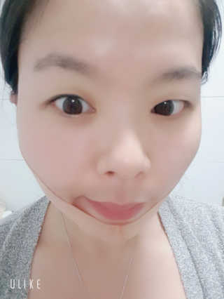 아이디플라코스메틱 아이디 페이스핏 마이너스 밴드 — 3점을 준 리뷰어가 2019년 11월 올린 사용 사진