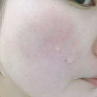 브루클린 보타니 Vitamin C Serum — 3.5점을 준 리뷰어가 2017년 4월 올린 사용 사진