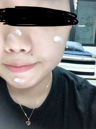 스케덤 클루덤 메디 에프터 크림 — 5점을 준 리뷰어가 2019년 2월 올린 사용 사진