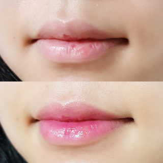 비니비니님이 올린 리뷰 사진 3