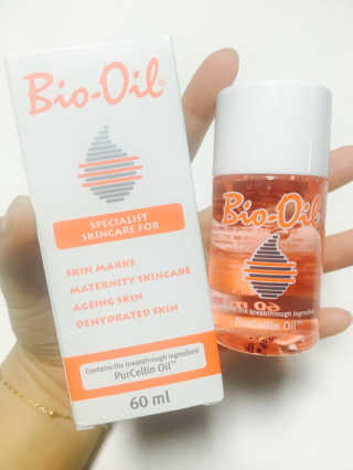 Bio-oil(바이오오일) 바이오오일 — 3.5점을 준 리뷰어가 2016년 10월 올린 사용 사진