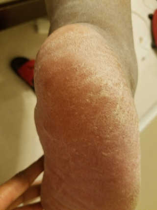 Mechio18님이 올린 리뷰 사진 2
