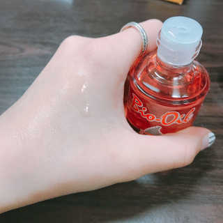 Bio-oil(바이오오일) 바이오오일(Bio-oil) — 4점을 준 리뷰어가 2017년 2월 올린 사용 사진