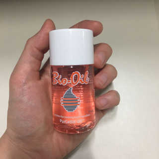 Bio-oil(바이오오일) 바이오오일(Bio-oil) — 5점을 준 리뷰어가 2017년 1월 올린 사용 사진
