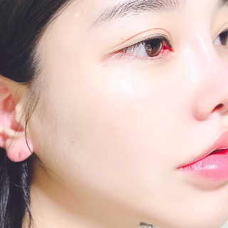 브이테라D 더마엘라비에 브이테라 D 발효 허니부쉬 에센스 — 5점을 준 리뷰어가 2019년 5월 올린 사용 사진