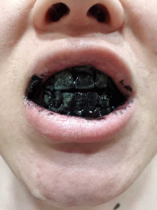 the naked object 디블랙팩치약 디블랙칫솔 세트 — 5점을 준 리뷰어가 2019년 1월 올린 사용 사진
