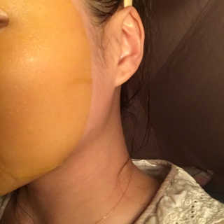 GoodDay Skincare GoodDay 강황 마스크 — 5점을 준 리뷰어가 2020년 3월 올린 사용 사진