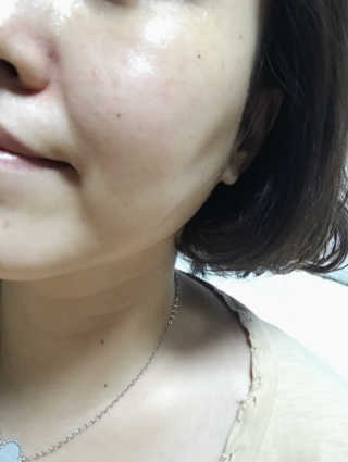 라루씨드 베러 미 릴렉싱 토너 — 4점을 준 리뷰어가 2019년 7월 올린 사용 사진