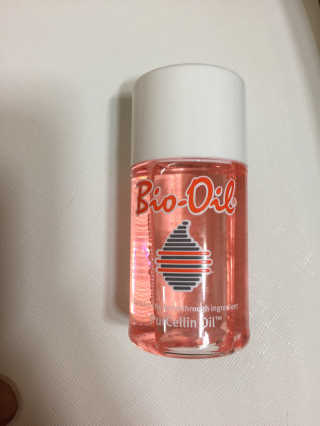 Bio-oil(바이오오일) 바이오오일 — 3.5점을 준 리뷰어가 2016년 10월 올린 사용 사진