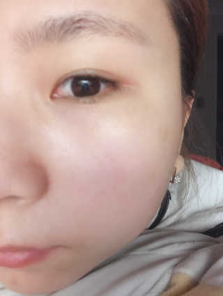 [더메디닥터] 글리셜 미셀라 클렌징 워터 — 5점을 준 리뷰어가 2019년 5월 올린 사용 사진