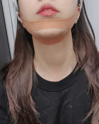 아이디플라코스메틱 아이디 페이스핏 마이너스 밴드 — 5점을 준 리뷰어가 2020년 1월 올린 사용 사진