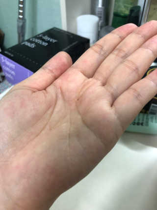 AHC 에이 에이치 씨 미니멀 10 워터리 에센스 — 5점을 준 리뷰어가 2018년 12월 올린 사용 사진