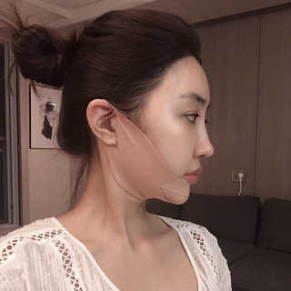 아이디플라코스메틱 아이디 페이스핏 마이너스 밴드 — 5점을 준 리뷰어가 2019년 9월 올린 사용 사진