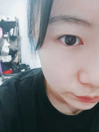 23years old 바데카실 프로 엑스퍼트 앰플 — 5점을 준 리뷰어가 2018년 6월 올린 사용 사진
