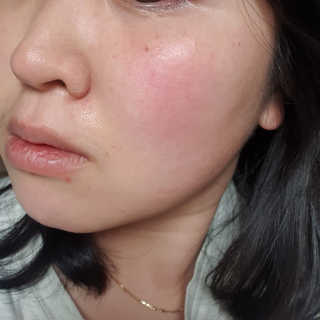 (주)에네스티 그린 티트리 딥 클렌징 워터 300ml — 5점을 준 리뷰어가 2020년 1월 올린 사용 사진