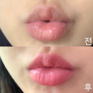미넴보떼 [조여정쿠션] 아쿠아 GG모이스쳐 쿠션 23호 — 5점을 준 리뷰어가 2019년 7월 올린 사용 사진