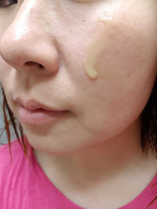 보타니티 [홍]조[진]정[결]케어 플라본 세럼 — 4.5점을 준 리뷰어가 2018년 5월 올린 사용 사진