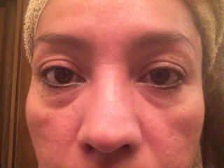 엘리자베카 밀키피기 하이드로겔 바운시 아이패치 — 4.17점을 준 리뷰어가 2017년 7월 올린 사용 사진