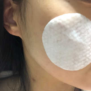 비알티씨 V10 필링패드 — 3점을 준 리뷰어가 2019년 1월 올린 사용 사진