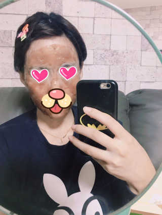 23years old 카카오 에너지 모델링 마스크 — 4점을 준 리뷰어가 2016년 12월 올린 사용 사진