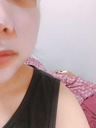 메디힐 제로솔루션 스킨차트 마스크4종 — 4.17점을 준 리뷰어가 2017년 7월 올린 사용 사진