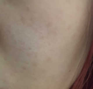 바디버든프로젝트 바디버든 프로젝트 BBP 시카 토너패드 — 4점을 준 리뷰어가 2019년 6월 올린 사용 사진
