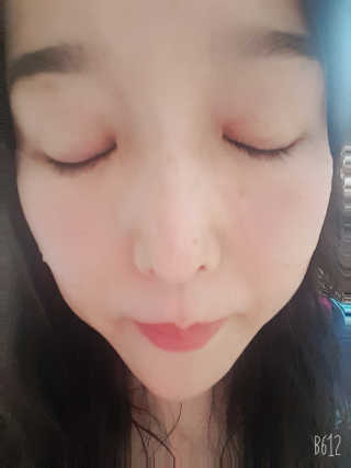 자이엘 S.O.S 레드 칙 케어팩 2 Box — 4.5점을 준 리뷰어가 2019년 11월 올린 사용 사진
