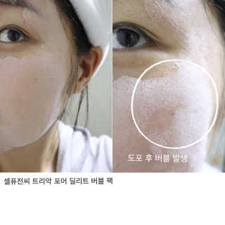 셀퓨전씨 트리악 포어 딜리트 버블 팩 — 4점을 준 리뷰어가 2018년 4월 올린 사용 사진