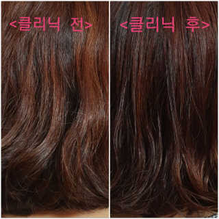 홈앤살롱 집에서 하는 모발클리닉 디스 이즈 앝 — 5점을 준 리뷰어가 2019년 8월 올린 사용 사진