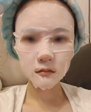 제너럴라이프 트로피칼뷰티 멜론마스크팩 코코넛마스크팩 20매 — 5점을 준 리뷰어가 2018년 6월 올린 사용 사진