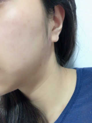 라포랩 laforlab 라포랩 센텔라스카 연고(바질) — 4.33점을 준 리뷰어가 2017년 12월 올린 사용 사진