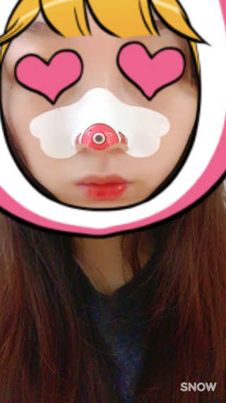 나이팅게일 TAKO PACK NOSE [문어코팩] — 4점을 준 리뷰어가 2016년 12월 올린 사용 사진