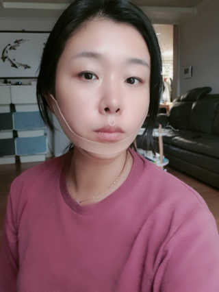 아이디플라코스메틱 아이디 페이스핏 마이너스 밴드 — 4점을 준 리뷰어가 2019년 10월 올린 사용 사진
