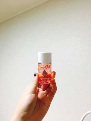 Bio-oil(바이오오일) 바이오오일(Bio-oil) — 3.5점을 준 리뷰어가 2017년 1월 올린 사용 사진