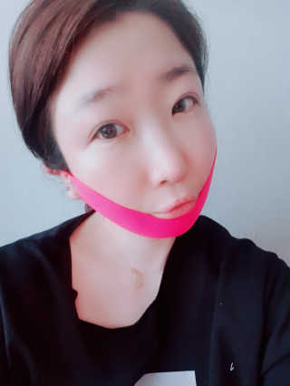 스케덤 펩타이드 리프팅밴드 — 5점을 준 리뷰어가 2019년 4월 올린 사용 사진